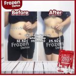 Frozen Detox 2 in 1 Slimming Capsule - Image 7