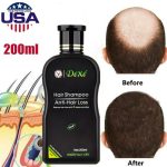 Dexe Hair Shampoo Anti Hair Loss - Image 7