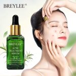 Breylee Acne Treatment Serum - Image 2