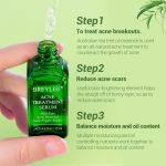 Breylee Acne Treatment Serum - Image 9