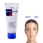 Mistine Acne Clear Facial Foam - Image 10