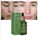 Breylee Acne Treatment Serum - Image 8