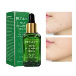 Breylee Acne Treatment Serum - Image 3
